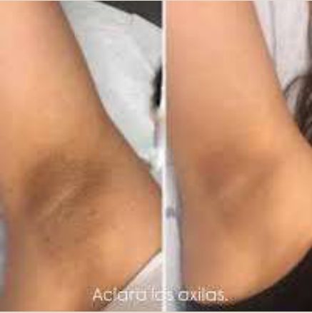Glycolic Acid 7% Exfoliating and Brightening Daily Toner, foto 2