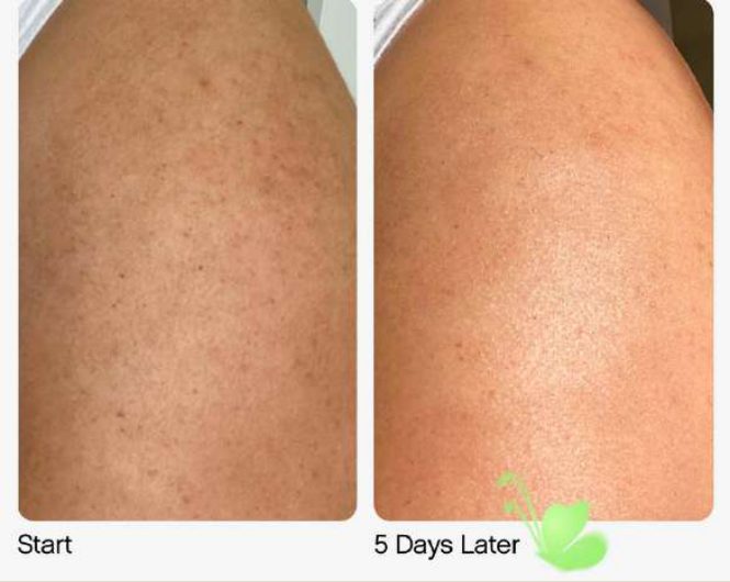 Slather Exfoliating Body Serum with Retinol and Ahas 50 Ml, foto 3