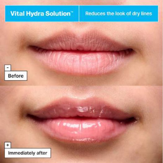 Vital Hydra Solution™ Jelly Bear Lip Mask with Hyaluronic Acid, foto 2