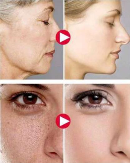 Niacinamida 10% + Zinc 1% 30 Ml — 60 ml, foto 2